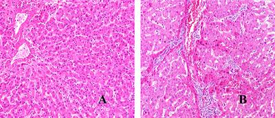 Kupffer Cells: Important Participant of Hepatic Alveolar Echinococcosis